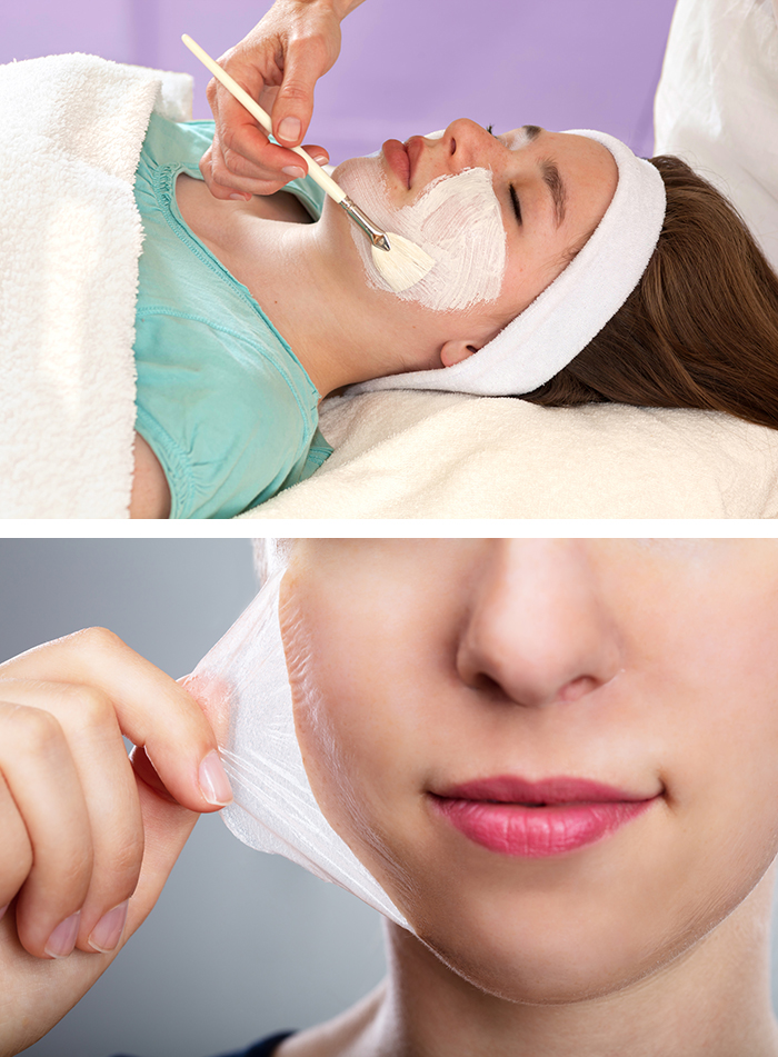 Chemical Peels Side Image